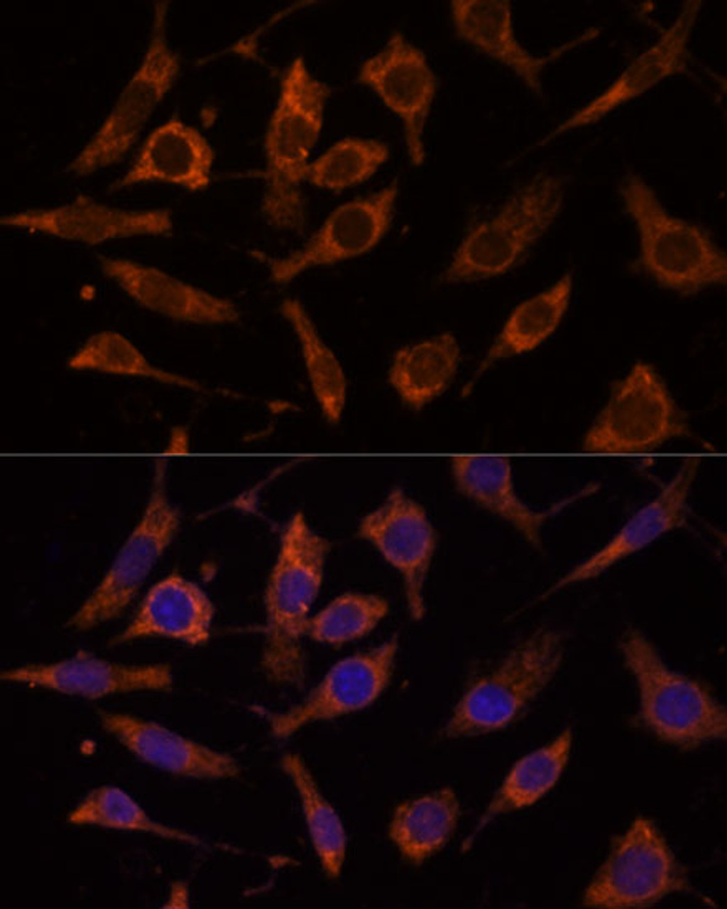 Immunofluorescence analysis of L929 cells using RPL24 Polyclonal Antibody (15-453) at dilution of 1:100 (40x lens) . Blue: DAPI for nuclear staining.