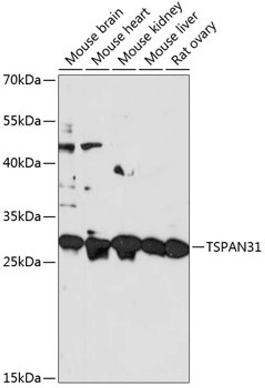 Western blot analysis of extracts of various cell lines, using TSPAN31 antibody (15-454) at 1:3000 dilution.<br/>Secondary antibody: HRP Goat Anti-Rabbit IgG (H+L) at 1:10000 dilution.<br/>Lysates/proteins: 25ug per lane.<br/>Blocking buffer: 3% nonfat dry milk in TBST.<br/>Detection: ECL Basic Kit.<br/>Exposure time: 60s.