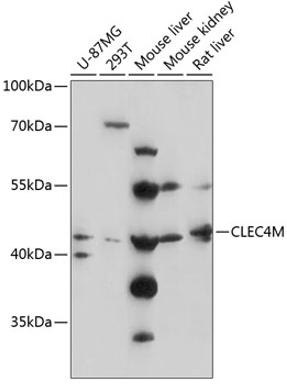 Western blot analysis of extracts of various cell lines, using CLEC4M antibody (15-457) at 1:3000 dilution.<br/>Secondary antibody: HRP Goat Anti-Rabbit IgG (H+L) at 1:10000 dilution.<br/>Lysates/proteins: 25ug per lane.<br/>Blocking buffer: 3% nonfat dry milk in TBST.<br/>Detection: ECL Basic Kit.<br/>Exposure time: 90s.