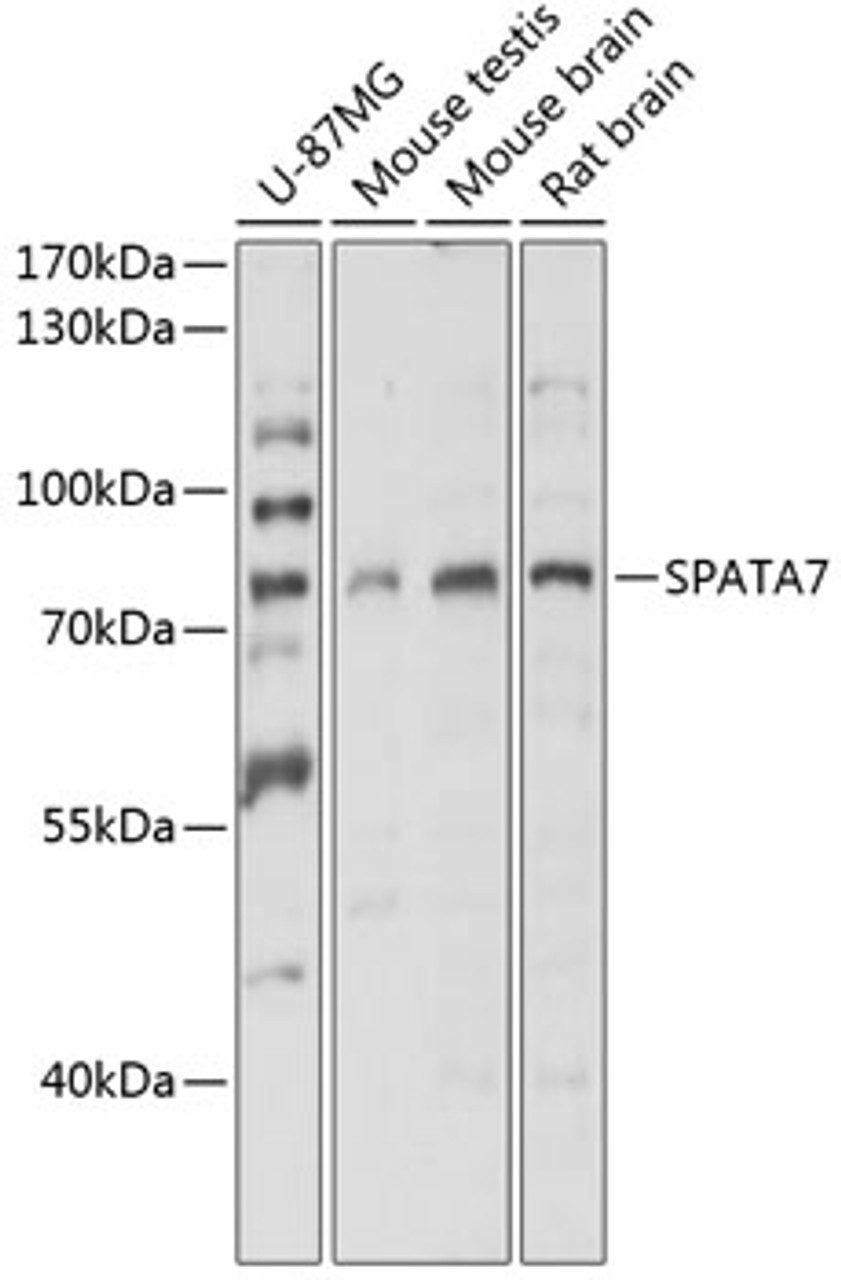 Western blot analysis of extracts of various cell lines, using SPATA7 antibody (15-467) at 1:3000 dilution.<br/>Secondary antibody: HRP Goat Anti-Rabbit IgG (H+L) at 1:10000 dilution.<br/>Lysates/proteins: 25ug per lane.<br/>Blocking buffer: 3% nonfat dry milk in TBST.<br/>Detection: ECL Basic Kit.<br/>Exposure time: 10s.