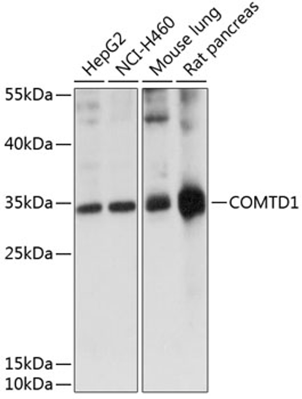 Western blot analysis of extracts of various cell lines, using COMTD1 antibody (15-474) at 1:1000 dilution.<br/>Secondary antibody: HRP Goat Anti-Rabbit IgG (H+L) at 1:10000 dilution.<br/>Lysates/proteins: 25ug per lane.<br/>Blocking buffer: 3% nonfat dry milk in TBST.<br/>Detection: ECL Basic Kit.<br/>Exposure time: 15s.