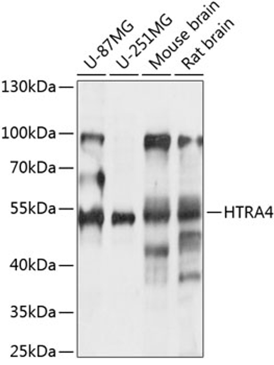 Western blot analysis of extracts of various cell lines, using HTRA4 antibody (15-480) at 1:1000 dilution.<br/>Secondary antibody: HRP Goat Anti-Rabbit IgG (H+L) at 1:10000 dilution.<br/>Lysates/proteins: 25ug per lane.<br/>Blocking buffer: 3% nonfat dry milk in TBST.<br/>Detection: ECL Basic Kit.<br/>Exposure time: 90s.