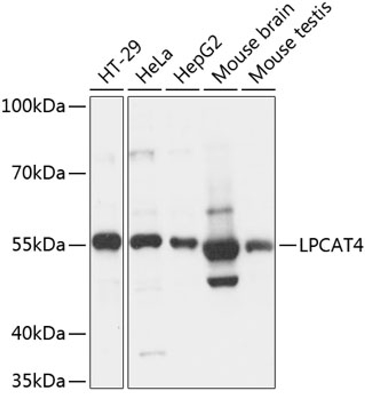 Western blot analysis of extracts of various cell lines, using LPCAT4 antibody (15-481) at 1:3000 dilution.<br/>Secondary antibody: HRP Goat Anti-Rabbit IgG (H+L) at 1:10000 dilution.<br/>Lysates/proteins: 25ug per lane.<br/>Blocking buffer: 3% nonfat dry milk in TBST.<br/>Detection: ECL Basic Kit.<br/>Exposure time: 1s.