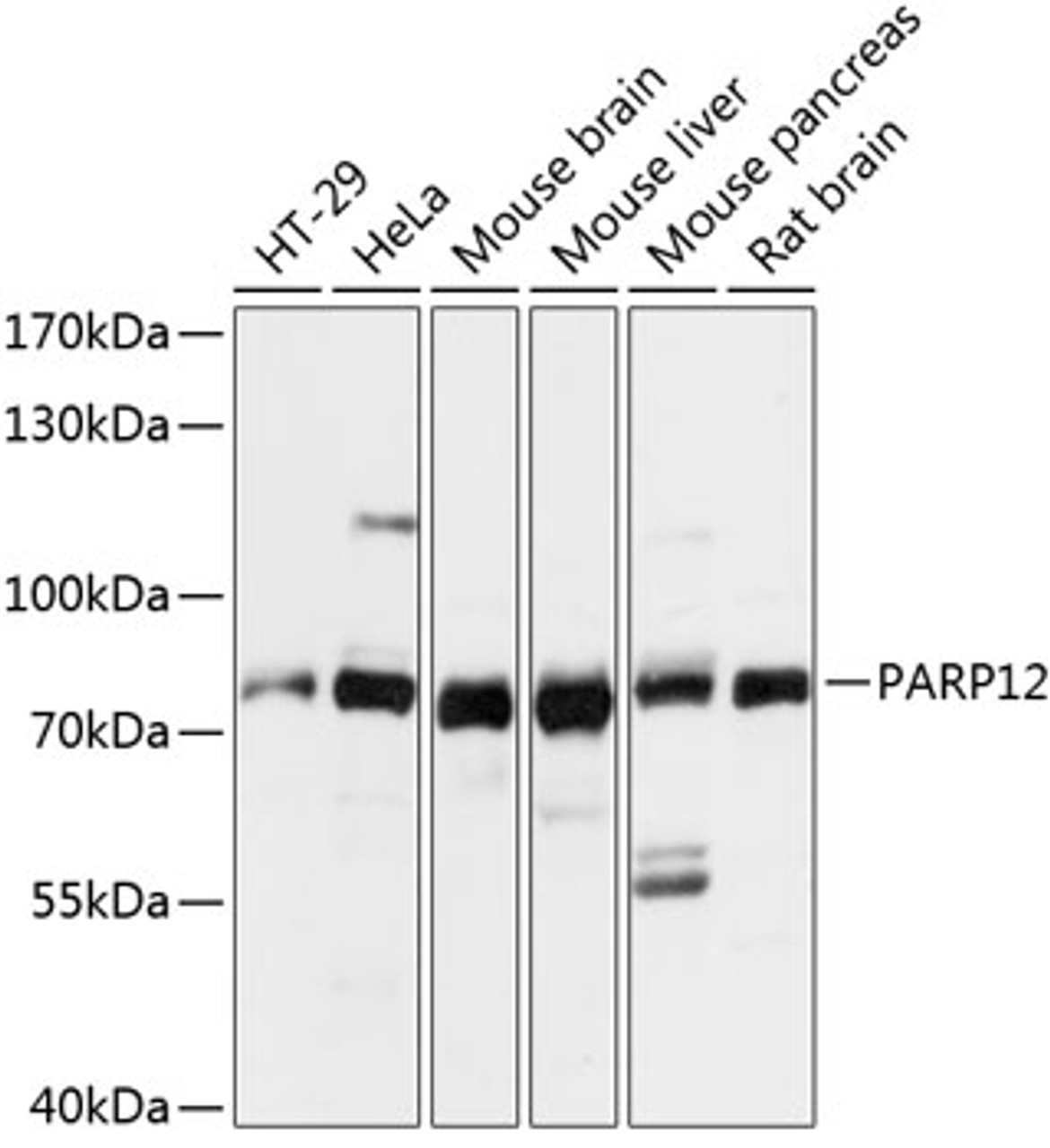 Western blot analysis of extracts of various cell lines, using PARP12 antibody (15-482) at 1:3000 dilution.<br/>Secondary antibody: HRP Goat Anti-Rabbit IgG (H+L) at 1:10000 dilution.<br/>Lysates/proteins: 25ug per lane.<br/>Blocking buffer: 3% nonfat dry milk in TBST.<br/>Detection: ECL Basic Kit.<br/>Exposure time: 10s.
