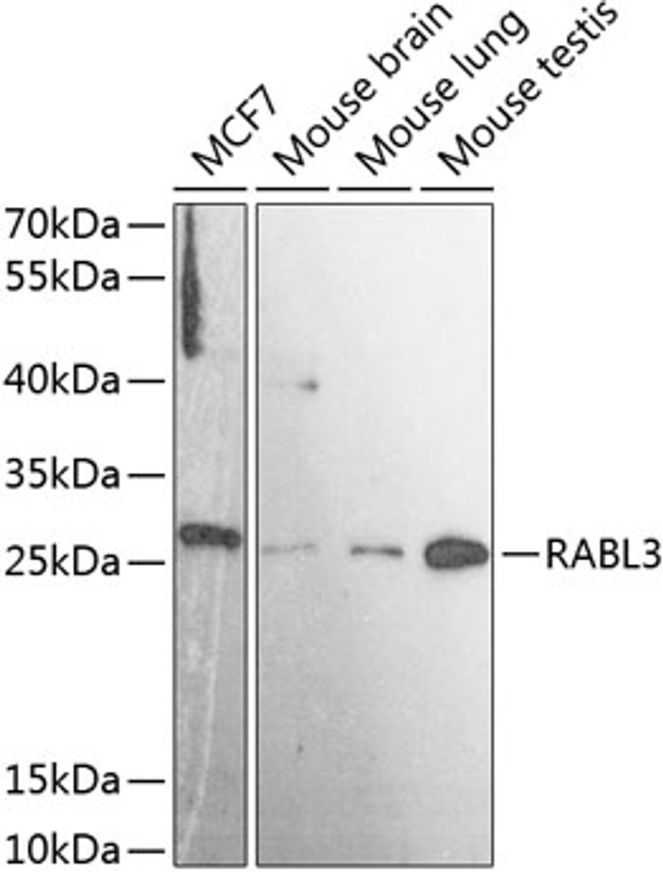 Western blot analysis of extracts of various cell lines, using RABL3 antibody (15-486) at 1:3000 dilution.<br/>Secondary antibody: HRP Goat Anti-Rabbit IgG (H+L) at 1:10000 dilution.<br/>Lysates/proteins: 25ug per lane.<br/>Blocking buffer: 3% nonfat dry milk in TBST.<br/>Detection: ECL Basic Kit.<br/>Exposure time: 90s.