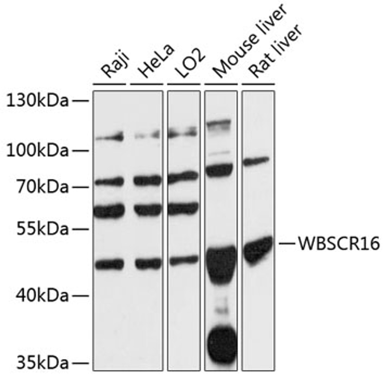 Western blot analysis of extracts of various cell lines, using WBSCR16 antibody (15-488) at 1:3000 dilution.<br/>Secondary antibody: HRP Goat Anti-Rabbit IgG (H+L) at 1:10000 dilution.<br/>Lysates/proteins: 25ug per lane.<br/>Blocking buffer: 3% nonfat dry milk in TBST.<br/>Detection: ECL Basic Kit.<br/>Exposure time: 30s.