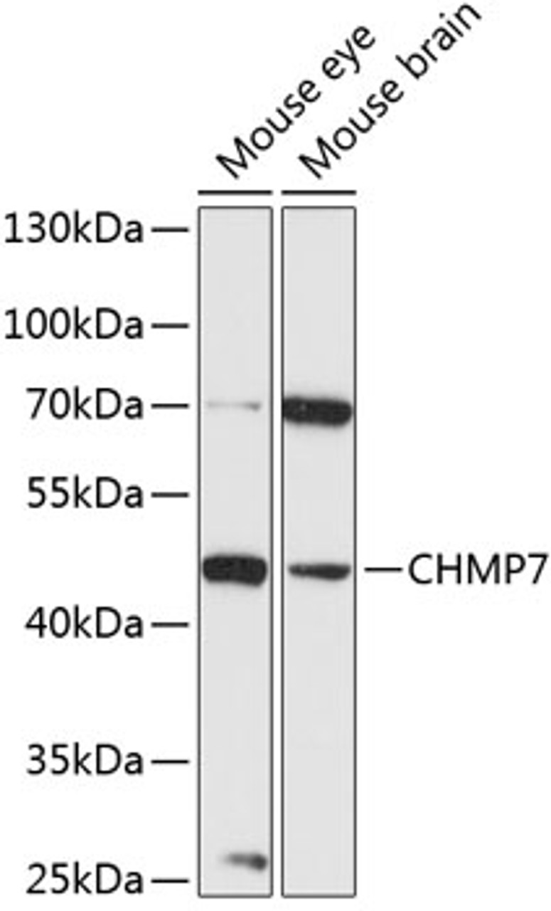 Western blot analysis of extracts of various cell lines, using CHMP7 antibody (15-489) at 1:3000 dilution.<br/>Secondary antibody: HRP Goat Anti-Rabbit IgG (H+L) at 1:10000 dilution.<br/>Lysates/proteins: 25ug per lane.<br/>Blocking buffer: 3% nonfat dry milk in TBST.<br/>Detection: ECL Basic Kit.<br/>Exposure time: 90s.
