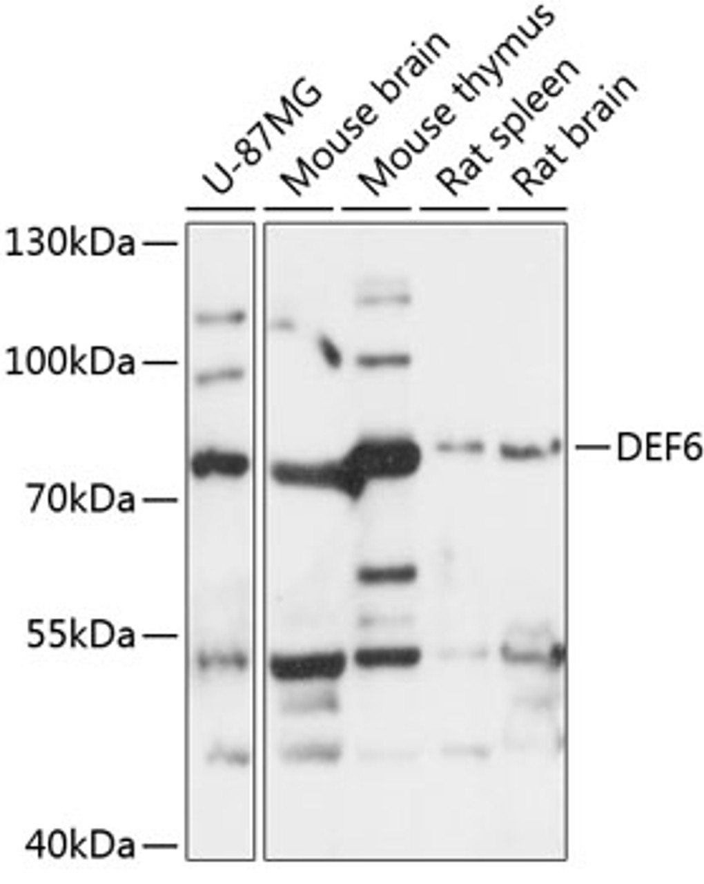 Western blot analysis of extracts of various cell lines, using DEF6 antibody (15-490) at 1:3000 dilution.<br/>Secondary antibody: HRP Goat Anti-Rabbit IgG (H+L) at 1:10000 dilution.<br/>Lysates/proteins: 25ug per lane.<br/>Blocking buffer: 3% nonfat dry milk in TBST.<br/>Detection: ECL Basic Kit.<br/>Exposure time: 10s.