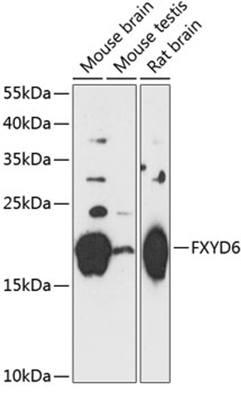 Western blot analysis of extracts of various cell lines, using FXYD6 antibody (15-491) at 1:3000 dilution.<br/>Secondary antibody: HRP Goat Anti-Rabbit IgG (H+L) at 1:10000 dilution.<br/>Lysates/proteins: 25ug per lane.<br/>Blocking buffer: 3% nonfat dry milk in TBST.<br/>Detection: ECL Basic Kit.<br/>Exposure time: 90s.