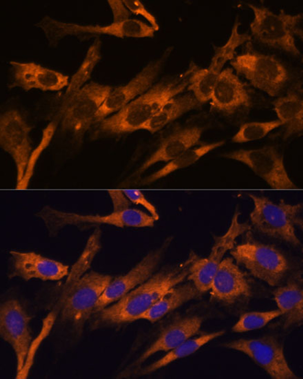 Immunofluorescence analysis of C6 cells using RPL36AL Polyclonal Antibody (15-505) at dilution of 1:100 (40x lens) . Blue: DAPI for nuclear staining.