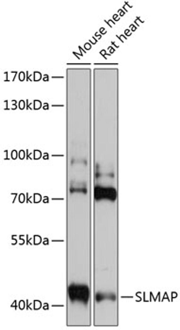 Western blot analysis of extracts of various cell lines, using SLMAP antibody (15-506) at 1:3000 dilution.<br/>Secondary antibody: HRP Goat Anti-Rabbit IgG (H+L) at 1:10000 dilution.<br/>Lysates/proteins: 25ug per lane.<br/>Blocking buffer: 3% nonfat dry milk in TBST.<br/>Detection: ECL Basic Kit.<br/>Exposure time: 30s.