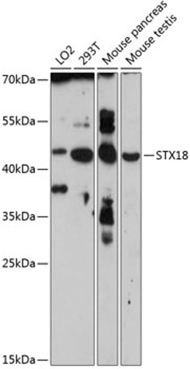 Western blot analysis of extracts of various cell lines, using STX18 antibody (15-507) at 1:3000 dilution.<br/>Secondary antibody: HRP Goat Anti-Rabbit IgG (H+L) at 1:10000 dilution.<br/>Lysates/proteins: 25ug per lane.<br/>Blocking buffer: 3% nonfat dry milk in TBST.<br/>Detection: ECL Enhanced Kit.<br/>Exposure time: 90s.