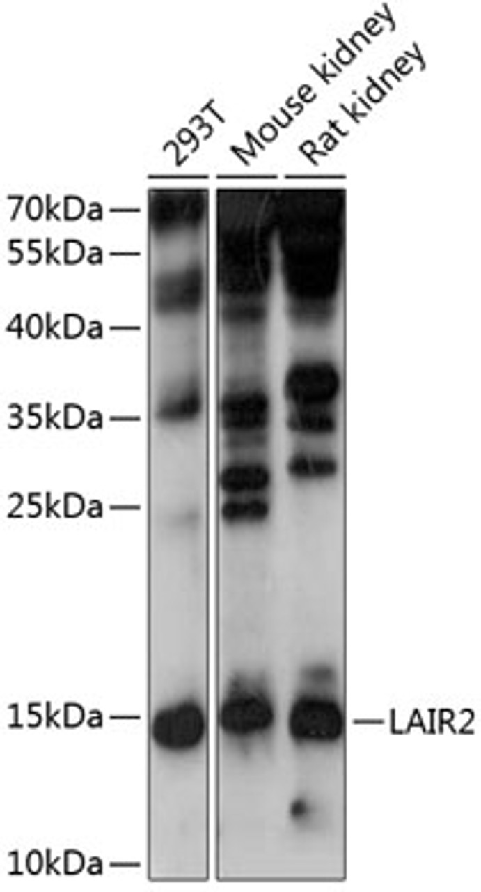 Western blot analysis of extracts of various cell lines, using LAIR2 antibody (15-510) at 1:1000 dilution.<br/>Secondary antibody: HRP Goat Anti-Rabbit IgG (H+L) at 1:10000 dilution.<br/>Lysates/proteins: 25ug per lane.<br/>Blocking buffer: 3% nonfat dry milk in TBST.<br/>Detection: ECL Enhanced Kit.<br/>Exposure time: 30s.