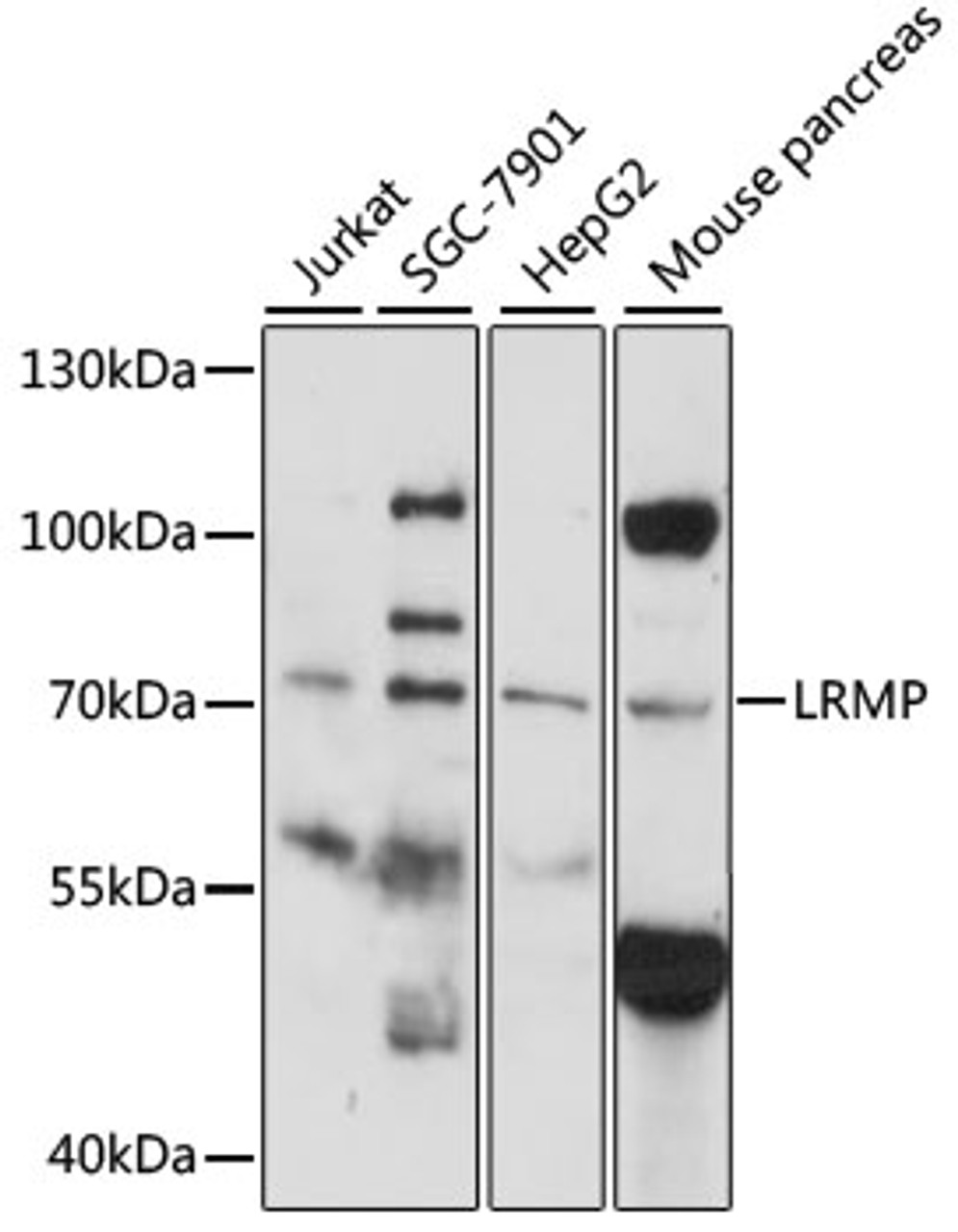 Western blot analysis of extracts of various cell lines, using LRMP antibody (15-511) at 1:1000 dilution.<br/>Secondary antibody: HRP Goat Anti-Rabbit IgG (H+L) at 1:10000 dilution.<br/>Lysates/proteins: 25ug per lane.<br/>Blocking buffer: 3% nonfat dry milk in TBST.<br/>Detection: ECL Basic Kit.<br/>Exposure time: 90s.