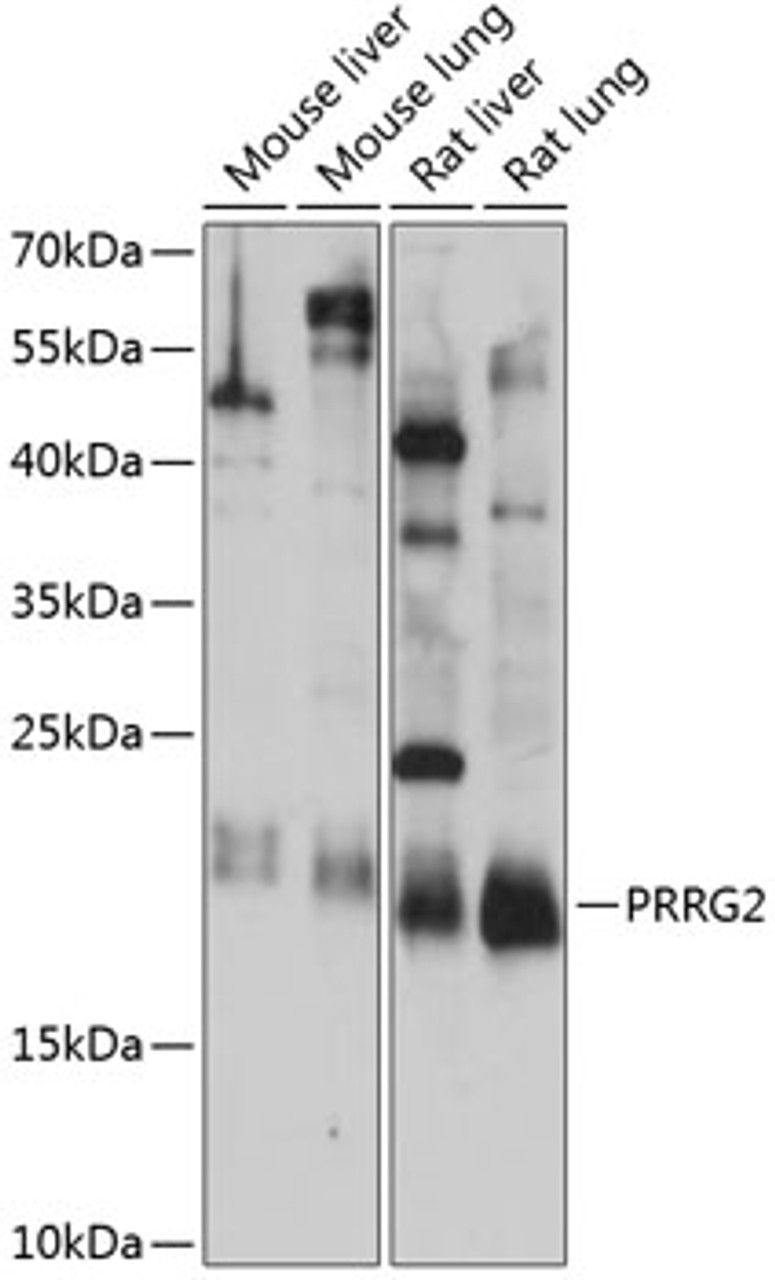 Western blot analysis of extracts of various cell lines, using PRRG2 antibody (15-514) at 1:1000 dilution.<br/>Secondary antibody: HRP Goat Anti-Rabbit IgG (H+L) at 1:10000 dilution.<br/>Lysates/proteins: 25ug per lane.<br/>Blocking buffer: 3% nonfat dry milk in TBST.<br/>Detection: ECL Basic Kit.<br/>Exposure time: 15s.