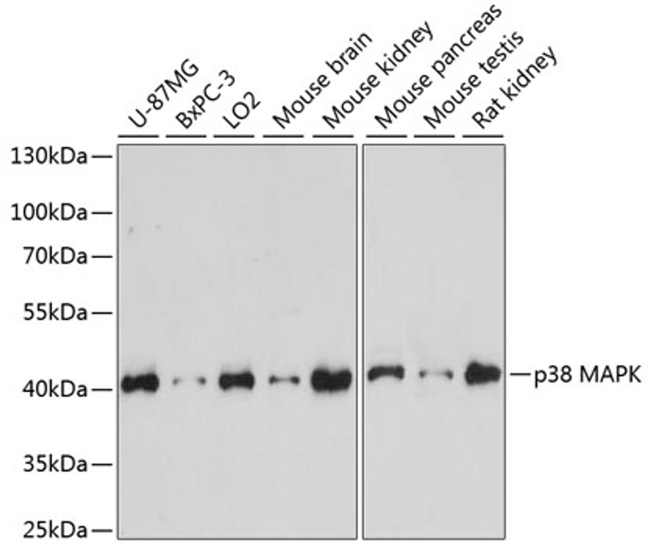 Western blot analysis of extracts of various cell lines, using p38 MAPK antibody (15-523) at 1:1000 dilution.<br/>Secondary antibody: HRP Goat Anti-Rabbit IgG (H+L) at 1:10000 dilution.<br/>Lysates/proteins: 25ug per lane.<br/>Blocking buffer: 3% nonfat dry milk in TBST.<br/>Detection: ECL Basic Kit.<br/>Exposure time: 30s.