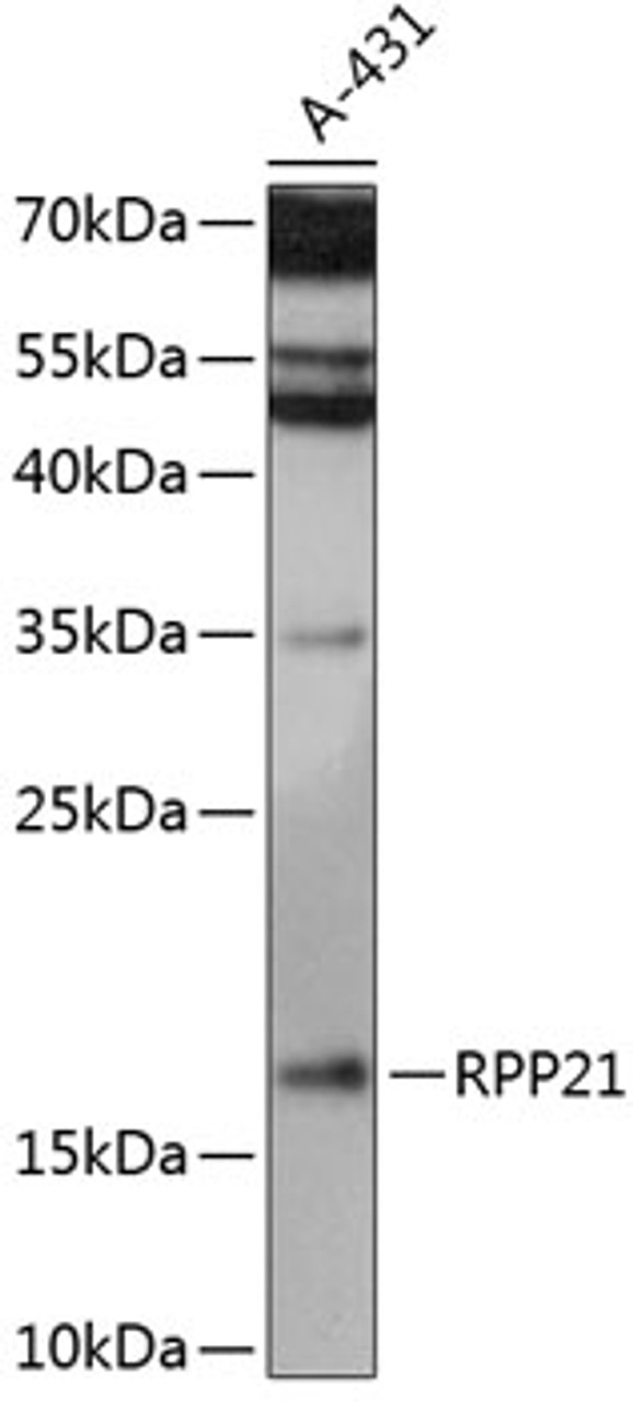 Western blot analysis of extracts of A431 cells, using RPP21 antibody (15-532) at 1:3000 dilution.<br/>Secondary antibody: HRP Goat Anti-Rabbit IgG (H+L) at 1:10000 dilution.<br/>Lysates/proteins: 25ug per lane.<br/>Blocking buffer: 3% nonfat dry milk in TBST.<br/>Detection: ECL Enhanced Kit.<br/>Exposure time: 15s.