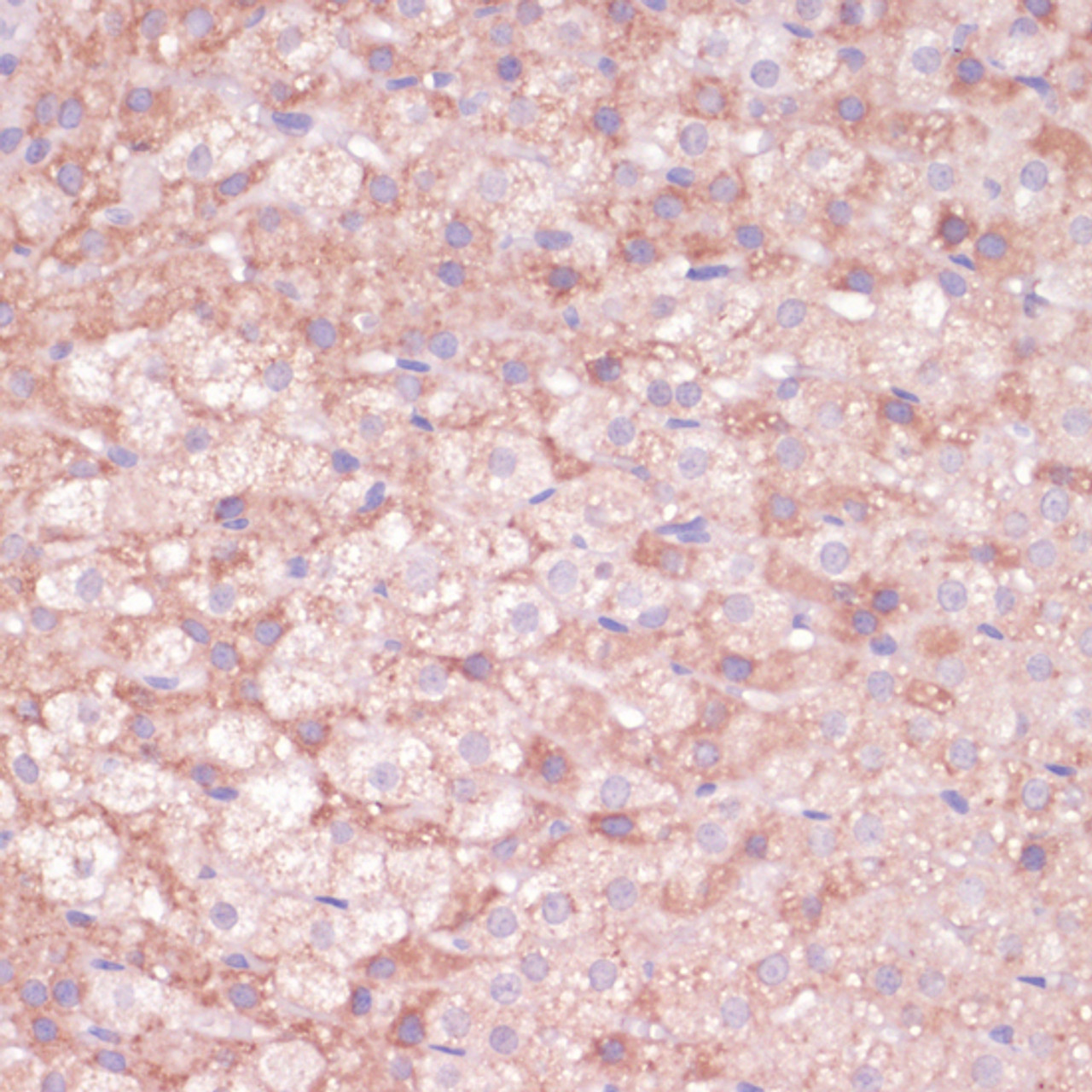 Immunohistochemistry of paraffin-embedded rat adrenal gland using CYP11B2 antibody (15-536) at dilution of 1:100 (40x lens) .
