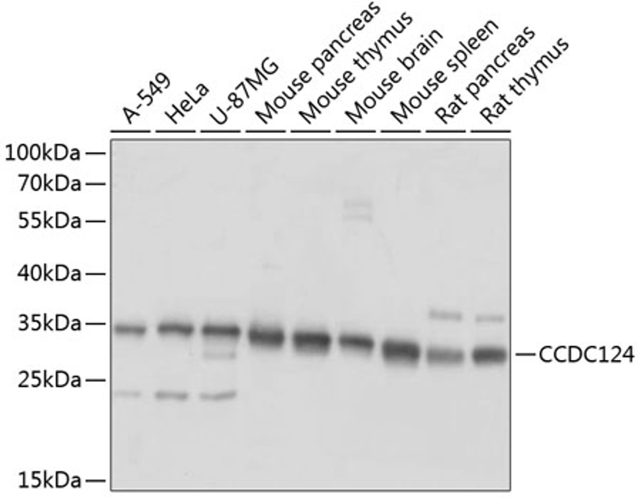 Western blot analysis of extracts of various cell lines, using CCDC124 antibody (15-541) at 1:1000 dilution.<br/>Secondary antibody: HRP Goat Anti-Rabbit IgG (H+L) at 1:10000 dilution.<br/>Lysates/proteins: 25ug per lane.<br/>Blocking buffer: 3% nonfat dry milk in TBST.<br/>Detection: ECL Basic Kit.<br/>Exposure time: 1s.