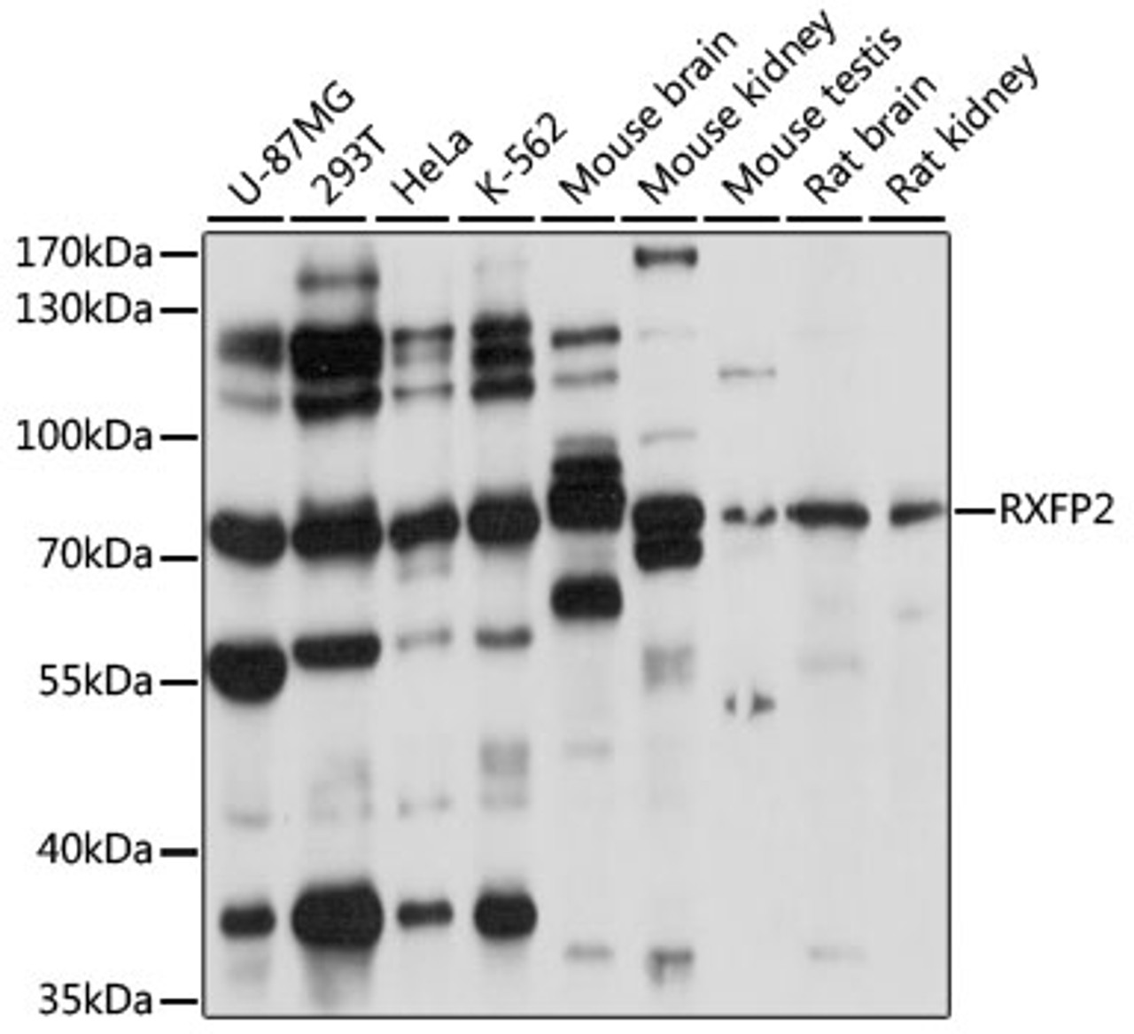 Western blot analysis of extracts of various cell lines, using RXFP2 antibody (15-544) at 1:1000 dilution.<br/>Secondary antibody: HRP Goat Anti-Rabbit IgG (H+L) at 1:10000 dilution.<br/>Lysates/proteins: 25ug per lane.<br/>Blocking buffer: 3% nonfat dry milk in TBST.<br/>Detection: ECL Basic Kit.<br/>Exposure time: 30s.