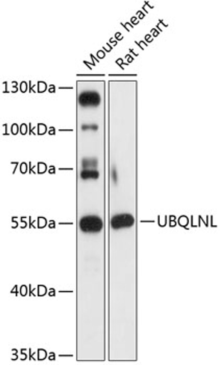 Western blot analysis of extracts of various cell lines, using UBQLNL antibody (15-549) at 1:3000 dilution.<br/>Secondary antibody: HRP Goat Anti-Rabbit IgG (H+L) at 1:10000 dilution.<br/>Lysates/proteins: 25ug per lane.<br/>Blocking buffer: 3% nonfat dry milk in TBST.<br/>Detection: ECL Basic Kit.<br/>Exposure time: 30s.
