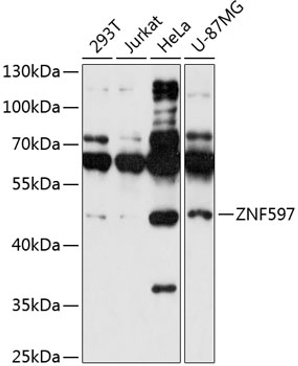 Western blot analysis of extracts of various cell lines, using ZNF597 antibody (15-550) at 1:1000 dilution.<br/>Secondary antibody: HRP Goat Anti-Rabbit IgG (H+L) at 1:10000 dilution.<br/>Lysates/proteins: 25ug per lane.<br/>Blocking buffer: 3% nonfat dry milk in TBST.<br/>Detection: ECL Basic Kit.<br/>Exposure time: 10s.