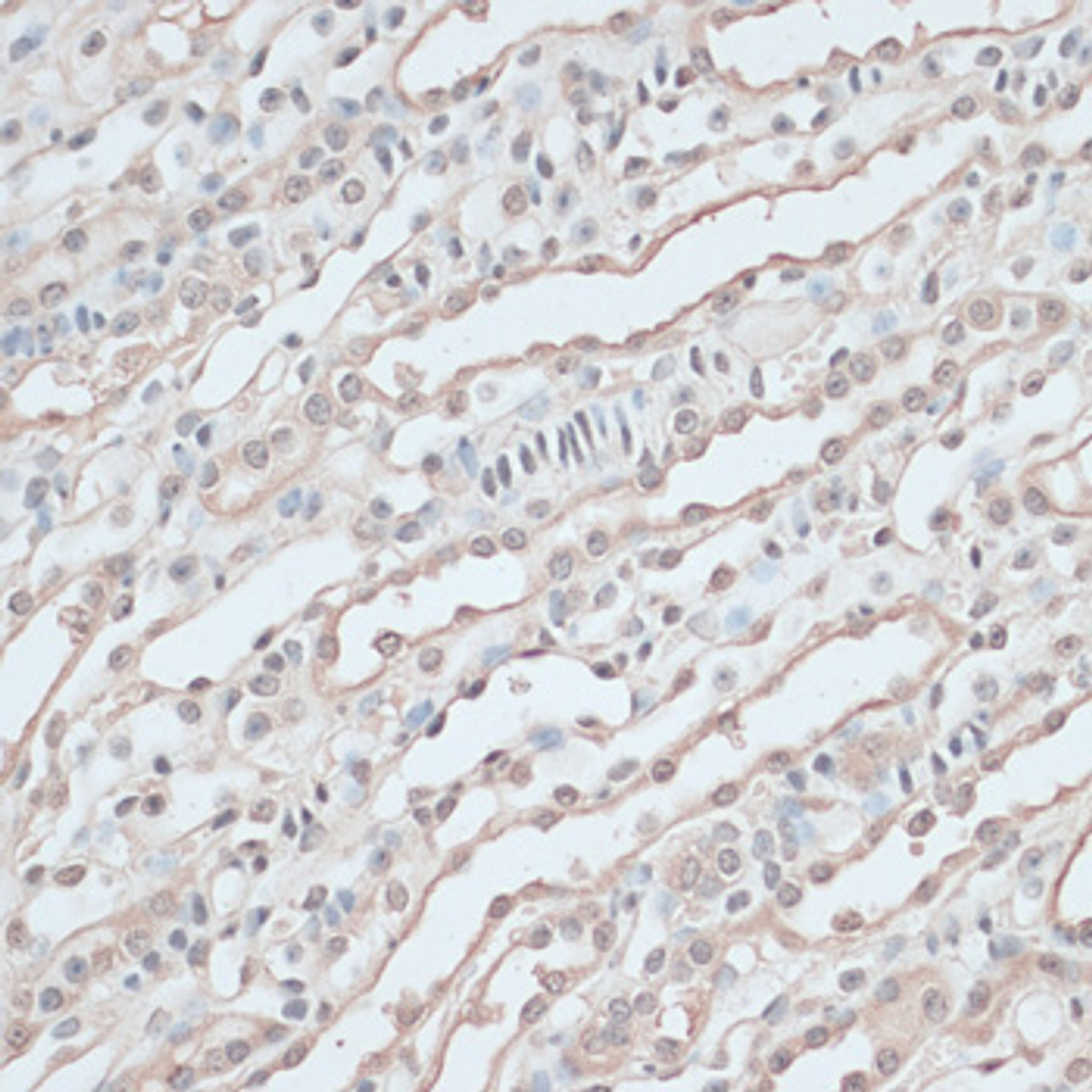 Immunohistochemistry of paraffin-embedded mouse kidney using ZNF597 antibody (15-550) at dilution of 1:100 (40x lens) .