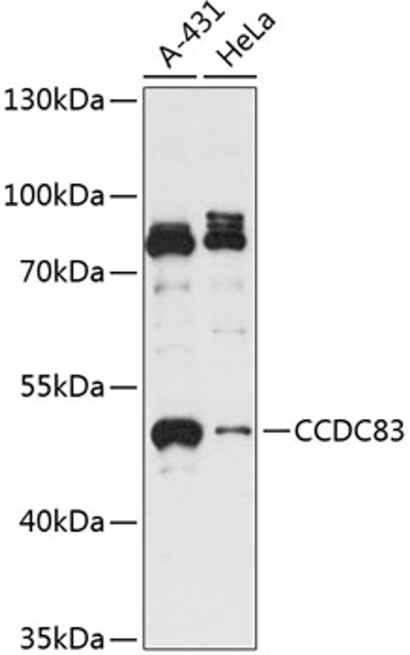 Western blot analysis of extracts of various cell lines, using CCDC83 antibody (15-554) at 1:3000 dilution.<br/>Secondary antibody: HRP Goat Anti-Rabbit IgG (H+L) at 1:10000 dilution.<br/>Lysates/proteins: 25ug per lane.<br/>Blocking buffer: 3% nonfat dry milk in TBST.<br/>Detection: ECL Basic Kit.<br/>Exposure time: 10s.