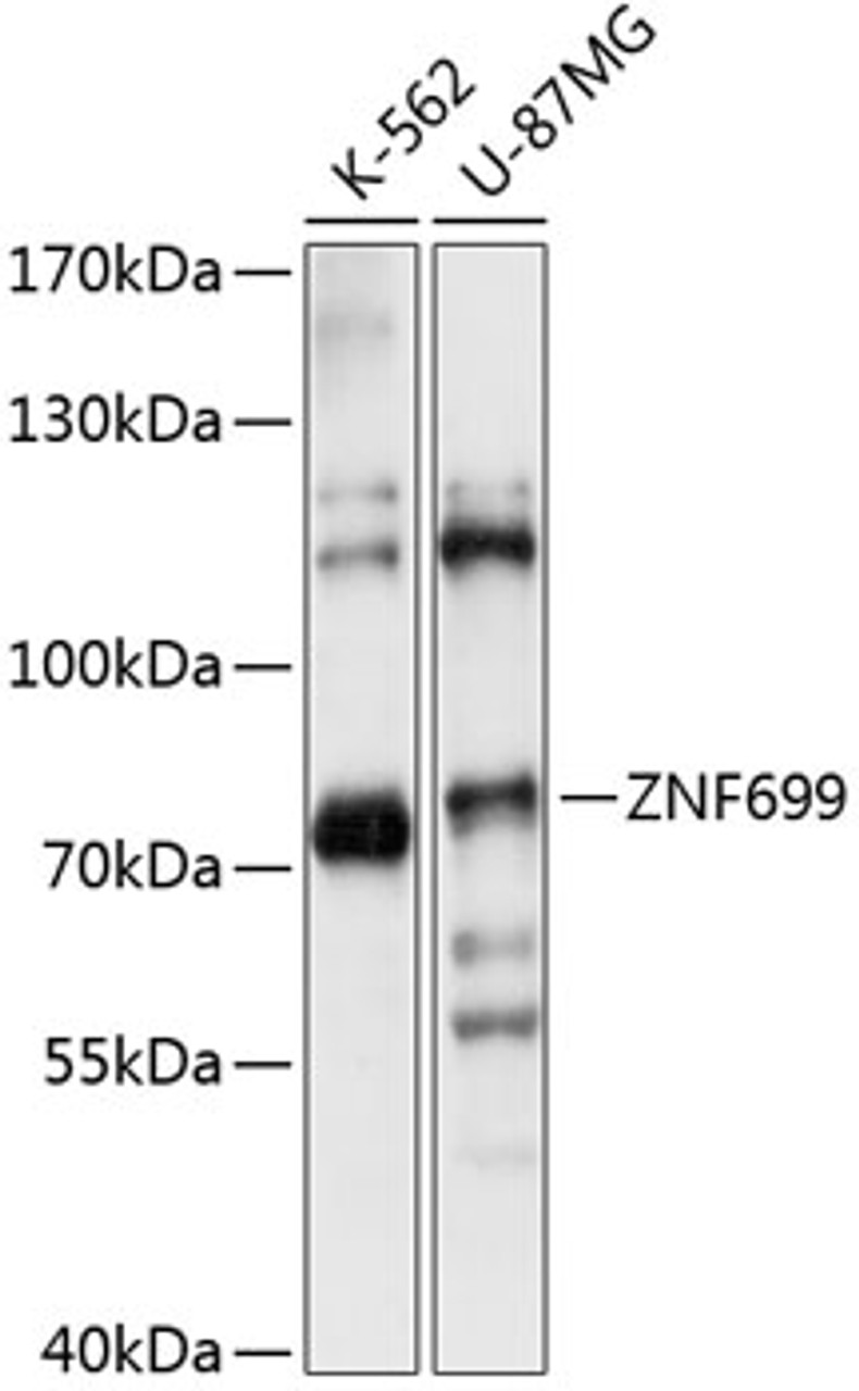 Western blot analysis of extracts of various cell lines, using ZNF699 antibody (15-556) at 1:1000 dilution.<br/>Secondary antibody: HRP Goat Anti-Rabbit IgG (H+L) at 1:10000 dilution.<br/>Lysates/proteins: 25ug per lane.<br/>Blocking buffer: 3% nonfat dry milk in TBST.<br/>Detection: ECL Basic Kit.<br/>Exposure time: 1s.