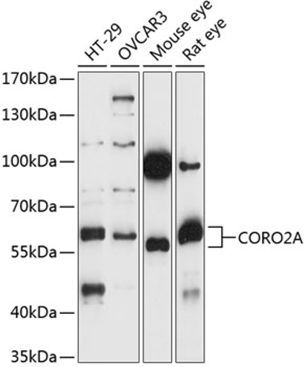 Western blot analysis of extracts of various cell lines, using CORO2A antibody (15-559) at 1:1000 dilution.<br/>Secondary antibody: HRP Goat Anti-Rabbit IgG (H+L) at 1:10000 dilution.<br/>Lysates/proteins: 25ug per lane.<br/>Blocking buffer: 3% nonfat dry milk in TBST.<br/>Detection: ECL Basic Kit.<br/>Exposure time: 30s.