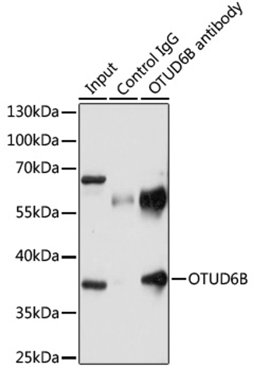 Immunoprecipitation analysis of 200ug extracts of U-87MG cells using 3ug OTUD6B antibody (15-578) . Western blot was performed from the immunoprecipitate using OTUD6B antibody (15-578) at a dilition of 1:1000.