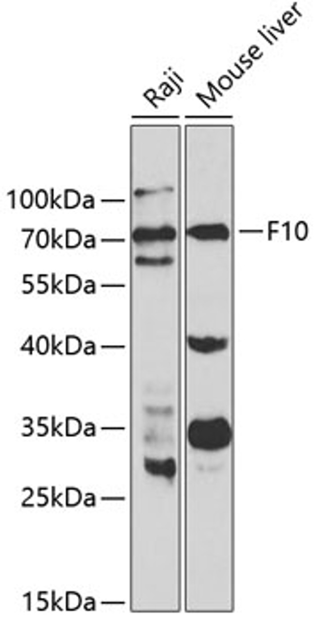 Western blot analysis of extracts of various cell lines, using F10 antibody (15-581) at 1:1000 dilution.<br/>Secondary antibody: HRP Goat Anti-Rabbit IgG (H+L) at 1:10000 dilution.<br/>Lysates/proteins: 25ug per lane.<br/>Blocking buffer: 3% nonfat dry milk in TBST.