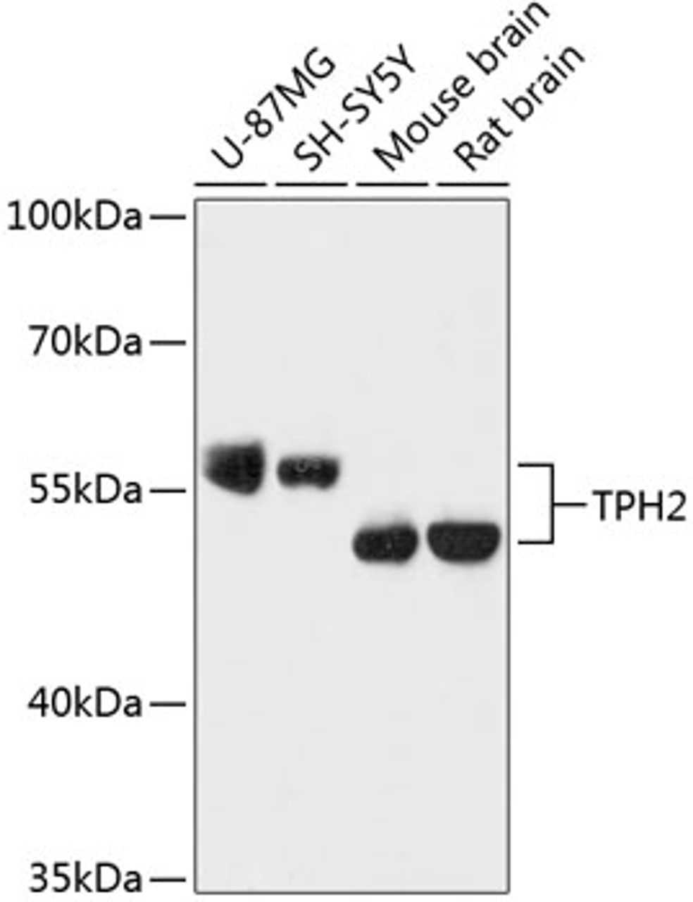 Western blot analysis of extracts of various cell lines, using TPH2 antibody (15-582) at 1:3000 dilution.<br/>Secondary antibody: HRP Goat Anti-Rabbit IgG (H+L) at 1:10000 dilution.<br/>Lysates/proteins: 25ug per lane.<br/>Blocking buffer: 3% nonfat dry milk in TBST.<br/>Detection: ECL Enhanced Kit.<br/>Exposure time: 30s.