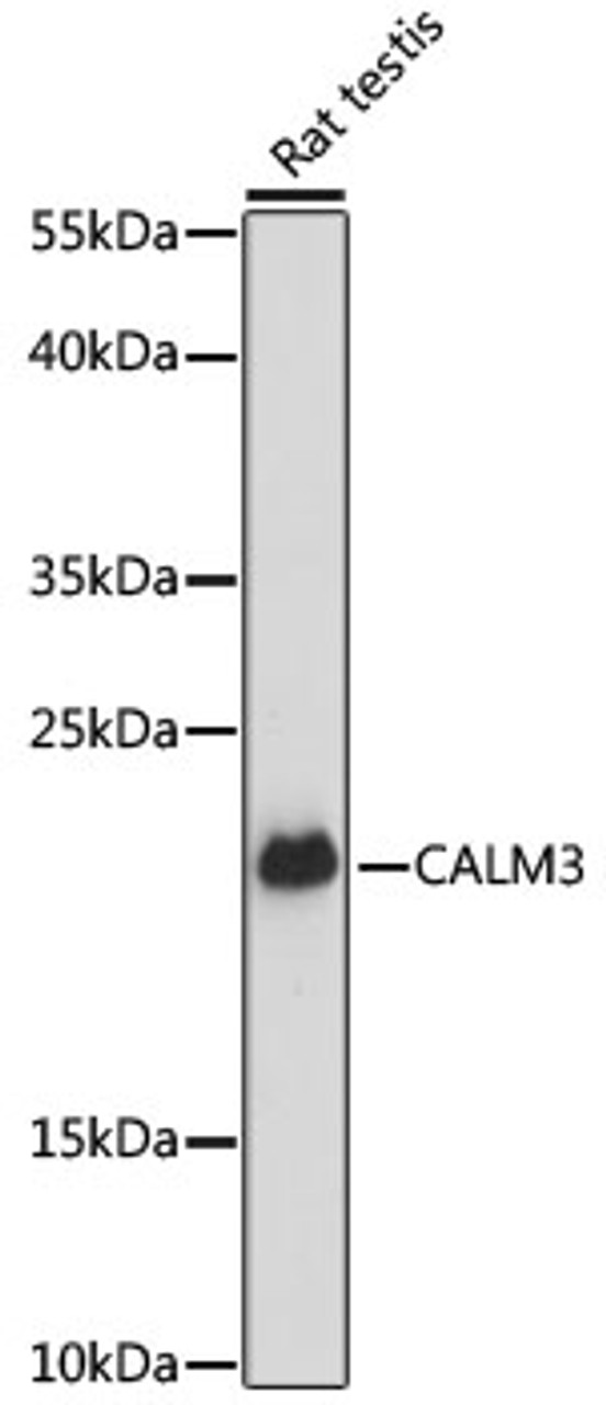 Western blot analysis of extracts of rat testis, using CALM3 antibody (15-584) at 1:3000 dilution.<br/>Secondary antibody: HRP Goat Anti-Rabbit IgG (H+L) at 1:10000 dilution.<br/>Lysates/proteins: 25ug per lane.<br/>Blocking buffer: 3% nonfat dry milk in TBST.<br/>Detection: ECL Enhanced Kit.<br/>Exposure time: 60s.