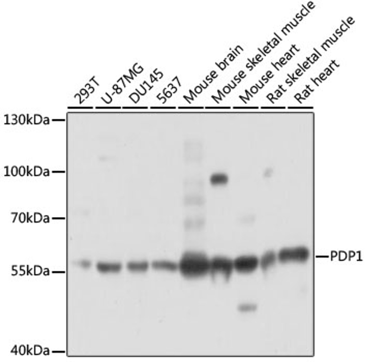 Western blot analysis of extracts of various cell lines, using PDP1 antibody (15-594) at 1:3000 dilution.<br/>Secondary antibody: HRP Goat Anti-Rabbit IgG (H+L) at 1:10000 dilution.<br/>Lysates/proteins: 25ug per lane.<br/>Blocking buffer: 3% nonfat dry milk in TBST.<br/>Detection: ECL Basic Kit.<br/>Exposure time: 1s.