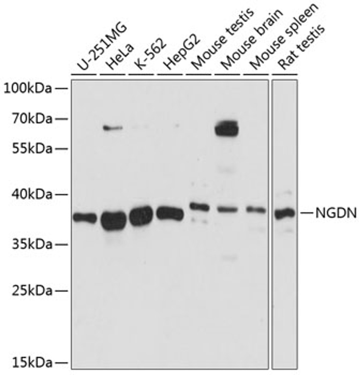 Western blot analysis of extracts of various cell lines, using NGDN antibody (15-595) at 1:3000 dilution.<br/>Secondary antibody: HRP Goat Anti-Rabbit IgG (H+L) at 1:10000 dilution.<br/>Lysates/proteins: 25ug per lane.<br/>Blocking buffer: 3% nonfat dry milk in TBST.<br/>Detection: ECL Basic Kit.<br/>Exposure time: 5s.