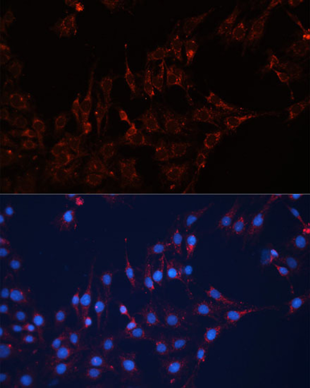 Immunofluorescence analysis of C6 cells using GNAI2 Polyclonal Antibody (15-596) at dilution of 1:100 (40x lens) . Blue: DAPI for nuclear staining.