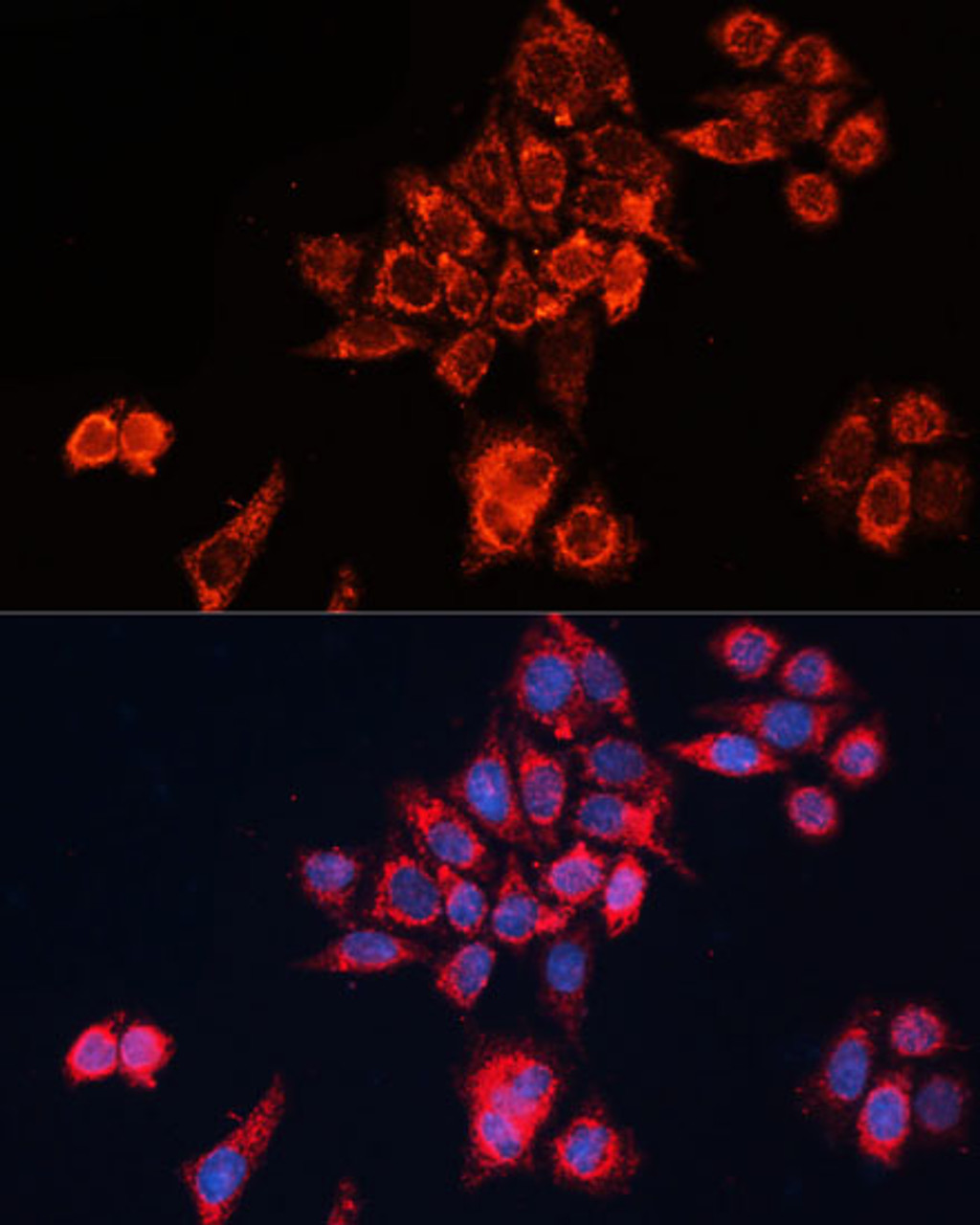 Immunofluorescence analysis of HeLa cells using GNAI2 Polyclonal Antibody (15-596) at dilution of 1:100 (40x lens) . Blue: DAPI for nuclear staining.