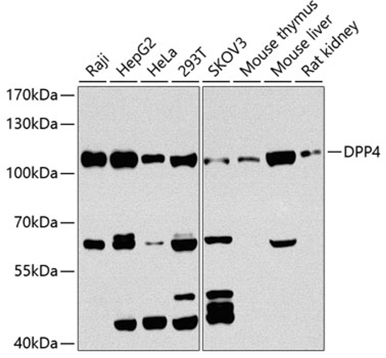 Western blot analysis of extracts of various cell lines, using DPP4 antibody (15-597) at 1:1000 dilution.<br/>Secondary antibody: HRP Goat Anti-Rabbit IgG (H+L) at 1:10000 dilution.<br/>Lysates/proteins: 25ug per lane.<br/>Blocking buffer: 3% nonfat dry milk in TBST.<br/>Detection: ECL Basic Kit.<br/>Exposure time: 60s.