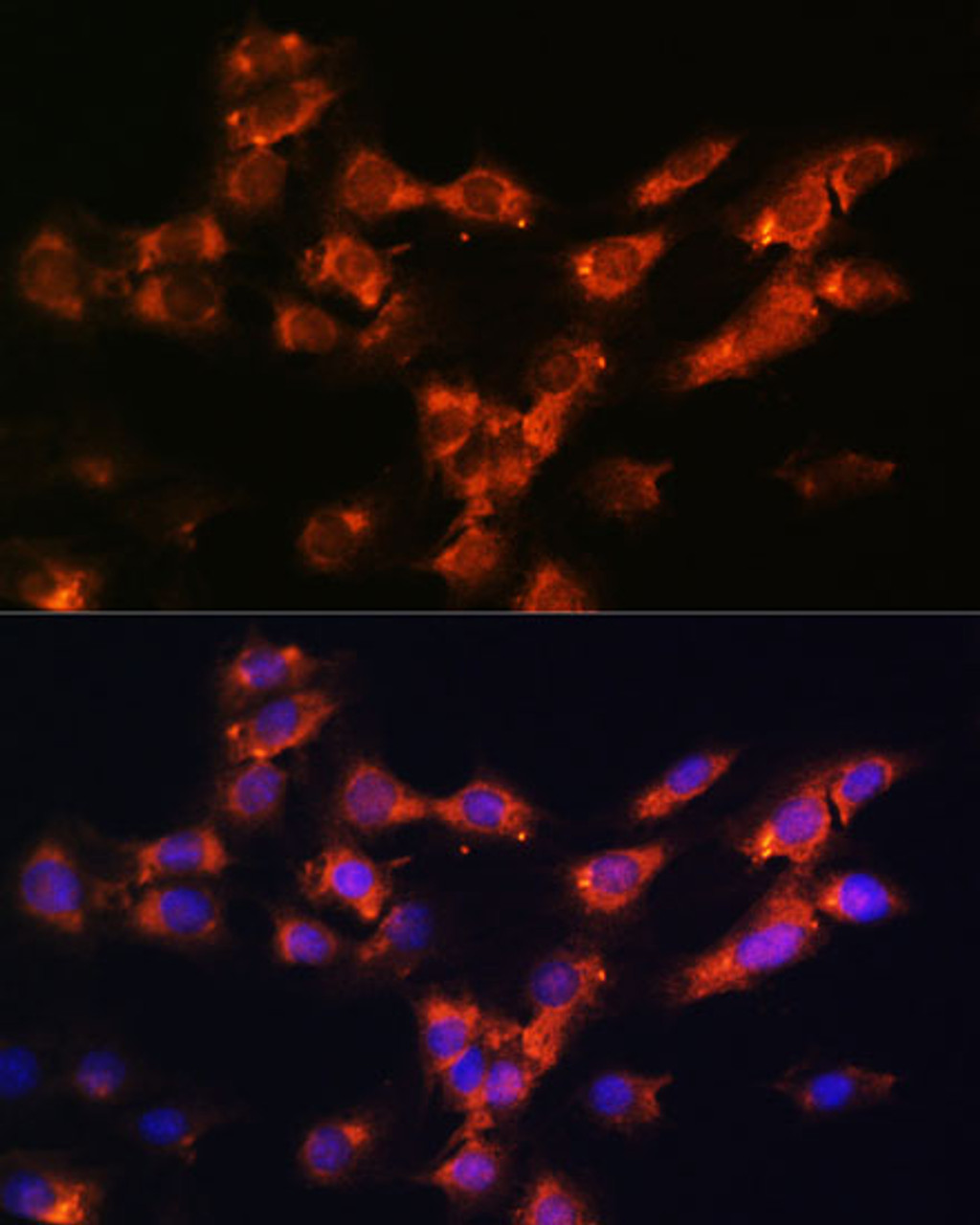 Immunofluorescence analysis of C6 cells using DPP4 antibody (15-597) at dilution of 1:100. Blue: DAPI for nuclear staining.