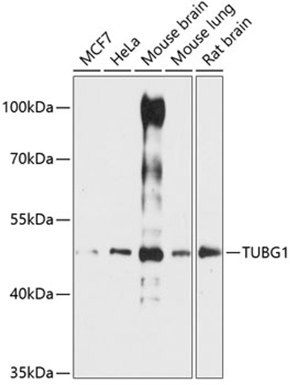 Western blot analysis of extracts of various cell lines, using TUBG1 antibody (15-599) at 1:3000 dilution.<br/>Secondary antibody: HRP Goat Anti-Rabbit IgG (H+L) at 1:10000 dilution.<br/>Lysates/proteins: 25ug per lane.<br/>Blocking buffer: 3% nonfat dry milk in TBST.<br/>Detection: ECL Basic Kit.<br/>Exposure time: 90s.