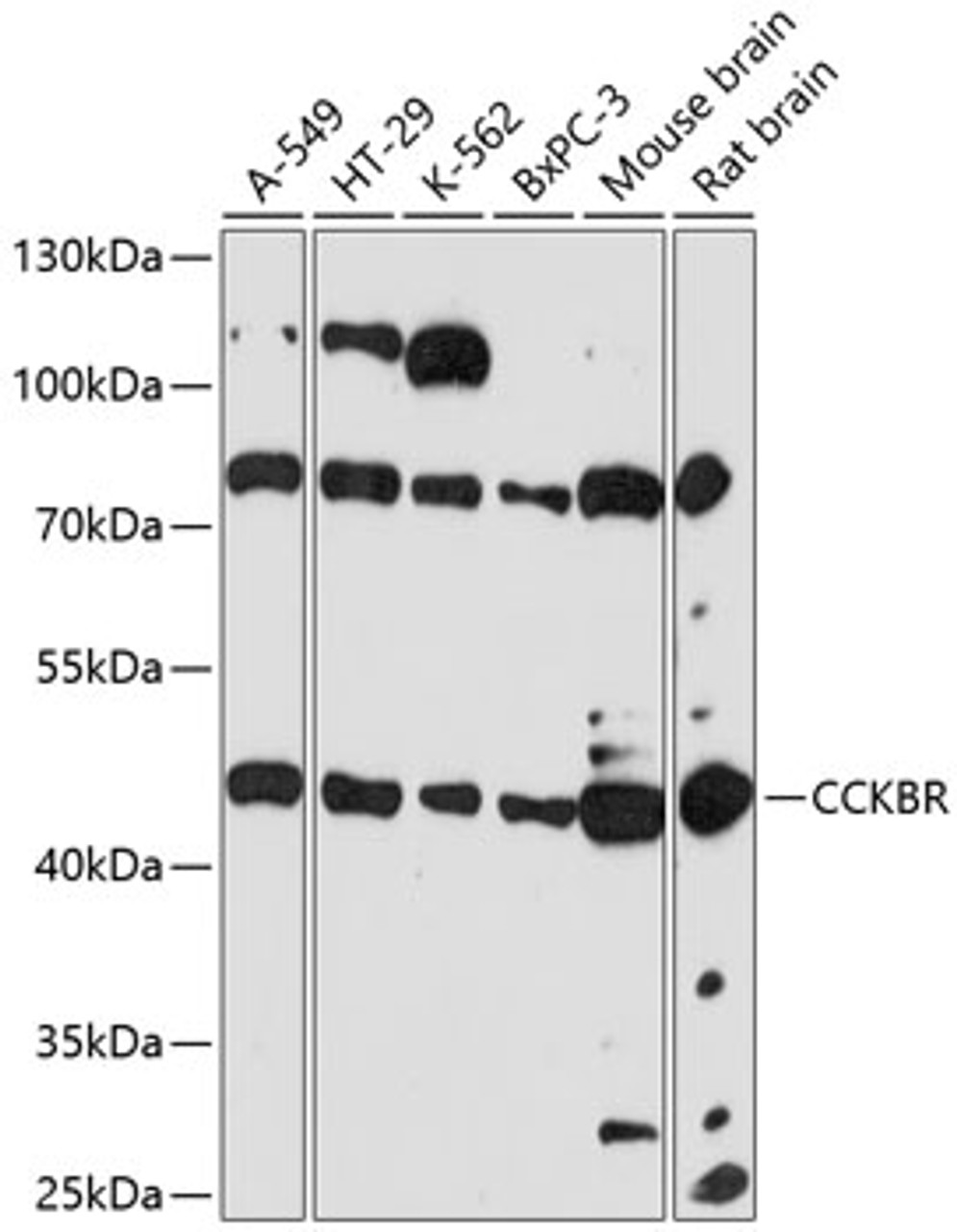 Western blot analysis of extracts of various cell lines, using CCKBR antibody (15-607) at 1:3000 dilution.<br/>Secondary antibody: HRP Goat Anti-Rabbit IgG (H+L) at 1:10000 dilution.<br/>Lysates/proteins: 25ug per lane.<br/>Blocking buffer: 3% nonfat dry milk in TBST.<br/>Detection: ECL Basic Kit.<br/>Exposure time: 90s.