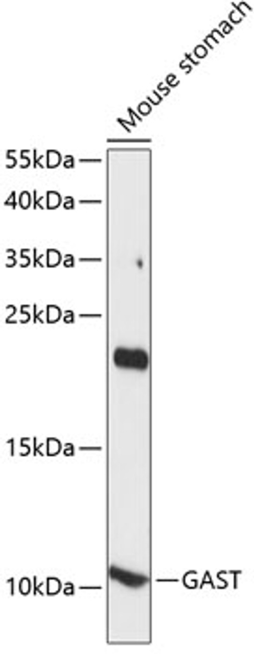 Western blot analysis of extracts of mouse stomach, using GAST antibody (15-609) at 1:1000 dilution.<br/>Secondary antibody: HRP Goat Anti-Rabbit IgG (H+L) at 1:10000 dilution.<br/>Lysates/proteins: 25ug per lane.<br/>Blocking buffer: 3% nonfat dry milk in TBST.<br/>Detection: ECL Basic Kit.<br/>Exposure time: 90s.