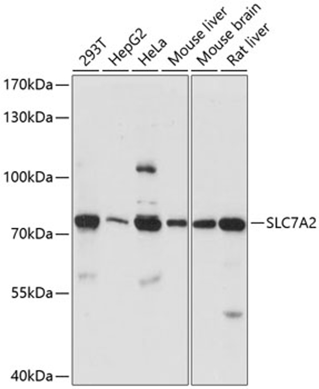 Western blot analysis of extracts of various cell lines, using SLC7A2 antibody (15-611) at 1:1000 dilution.<br/>Secondary antibody: HRP Goat Anti-Rabbit IgG (H+L) at 1:10000 dilution.<br/>Lysates/proteins: 25ug per lane.<br/>Blocking buffer: 3% nonfat dry milk in TBST.<br/>Detection: ECL Basic Kit.<br/>Exposure time: 90s.