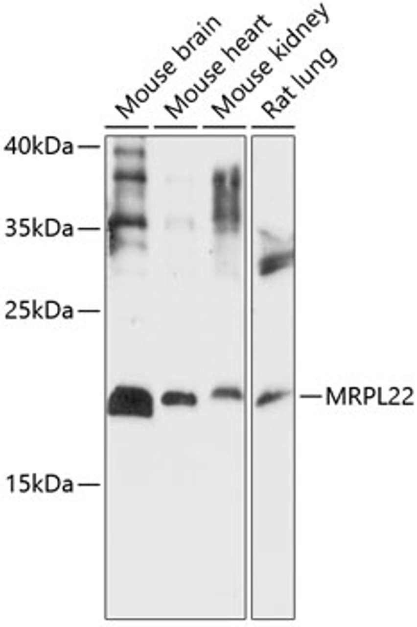 Western blot analysis of extracts of various cell lines, using MRPL22 antibody (15-617) at 1:1000 dilution.<br/>Secondary antibody: HRP Goat Anti-Rabbit IgG (H+L) at 1:10000 dilution.<br/>Lysates/proteins: 25ug per lane.<br/>Blocking buffer: 3% nonfat dry milk in TBST.<br/>Detection: ECL Basic Kit.<br/>Exposure time: 30s.