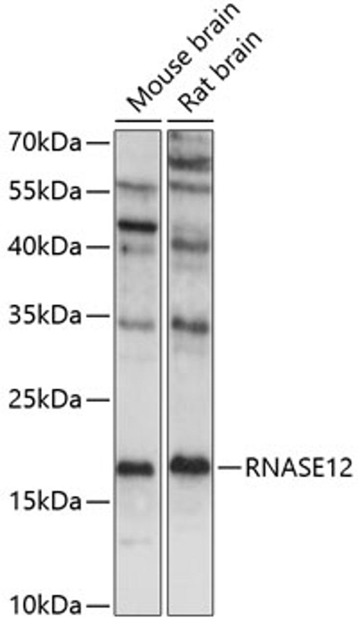 Western blot analysis of extracts of various cell lines, using RNASE12 antibody (15-627) at 1:1000 dilution.<br/>Secondary antibody: HRP Goat Anti-Rabbit IgG (H+L) at 1:10000 dilution.<br/>Lysates/proteins: 25ug per lane.<br/>Blocking buffer: 3% nonfat dry milk in TBST.<br/>Detection: ECL Basic Kit.<br/>Exposure time: 90s.
