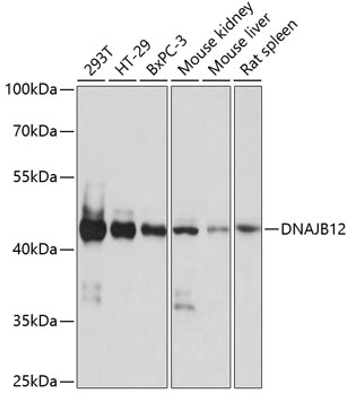 Western blot analysis of extracts of various cell lines, using DNAJB12 antibody (15-638) at 1:1000 dilution.<br/>Secondary antibody: HRP Goat Anti-Rabbit IgG (H+L) at 1:10000 dilution.<br/>Lysates/proteins: 25ug per lane.<br/>Blocking buffer: 3% nonfat dry milk in TBST.<br/>Detection: ECL Basic Kit.<br/>Exposure time: 10s.