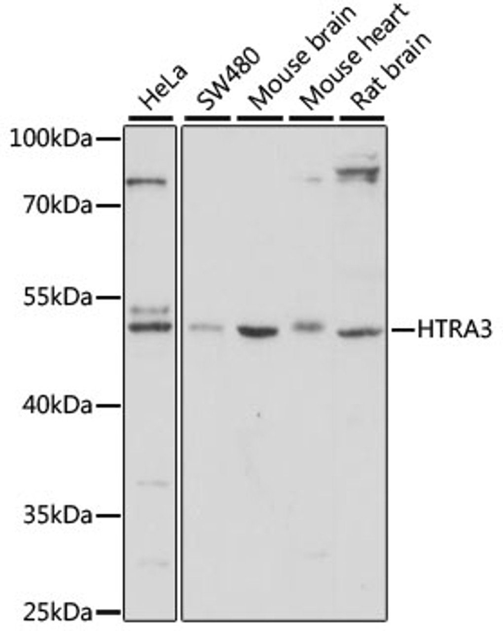 Western blot analysis of extracts of various cell lines, using HTRA3 antibody (15-649) at 1:1000 dilution.<br/>Secondary antibody: HRP Goat Anti-Rabbit IgG (H+L) at 1:10000 dilution.<br/>Lysates/proteins: 25ug per lane.<br/>Blocking buffer: 3% nonfat dry milk in TBST.<br/>Detection: ECL Basic Kit.<br/>Exposure time: 90s.