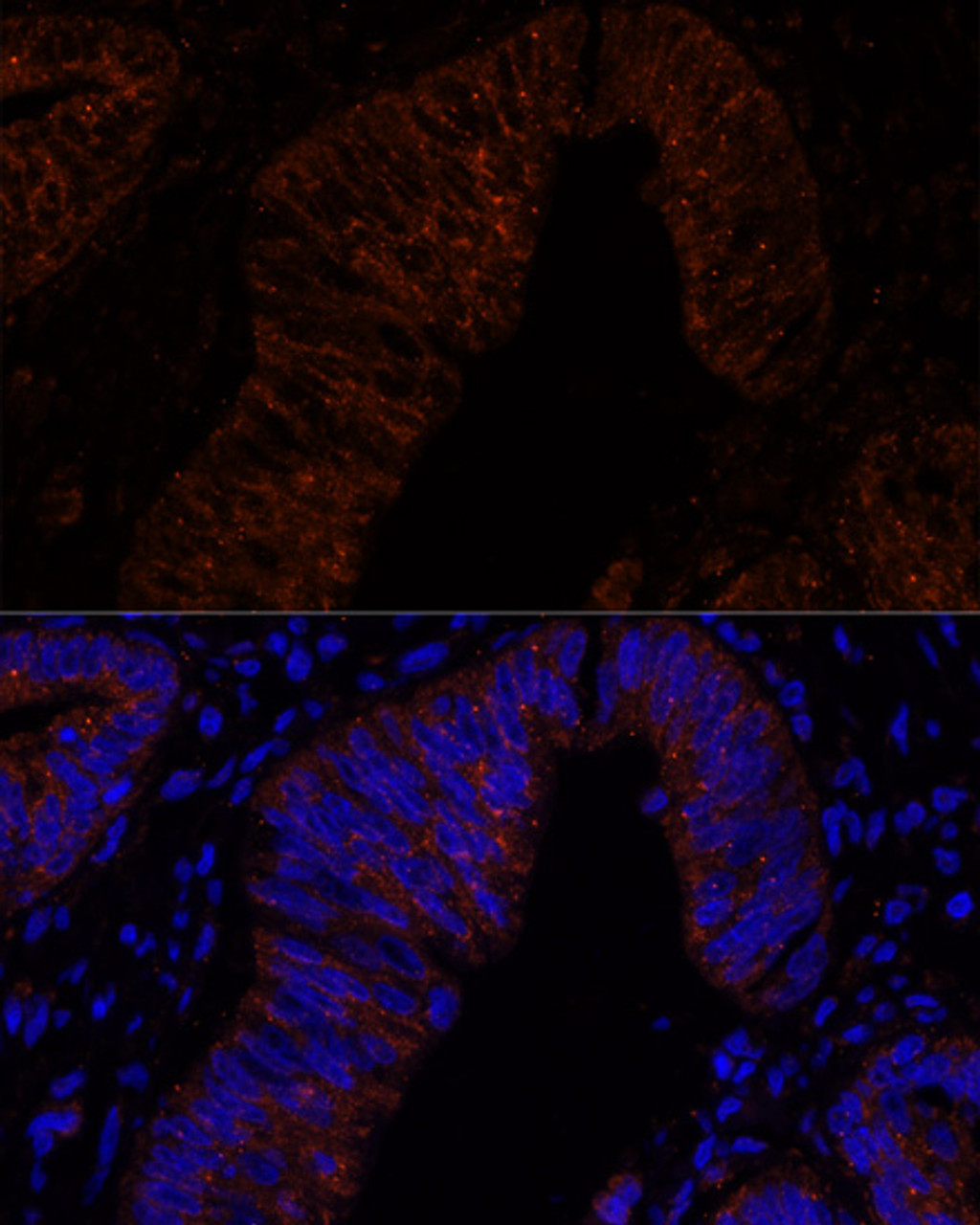 Immunofluorescence analysis of human colon carcinoma cells using MUC2 antibody (15-657) at dilution of 1:100. Blue: DAPI for nuclear staining.