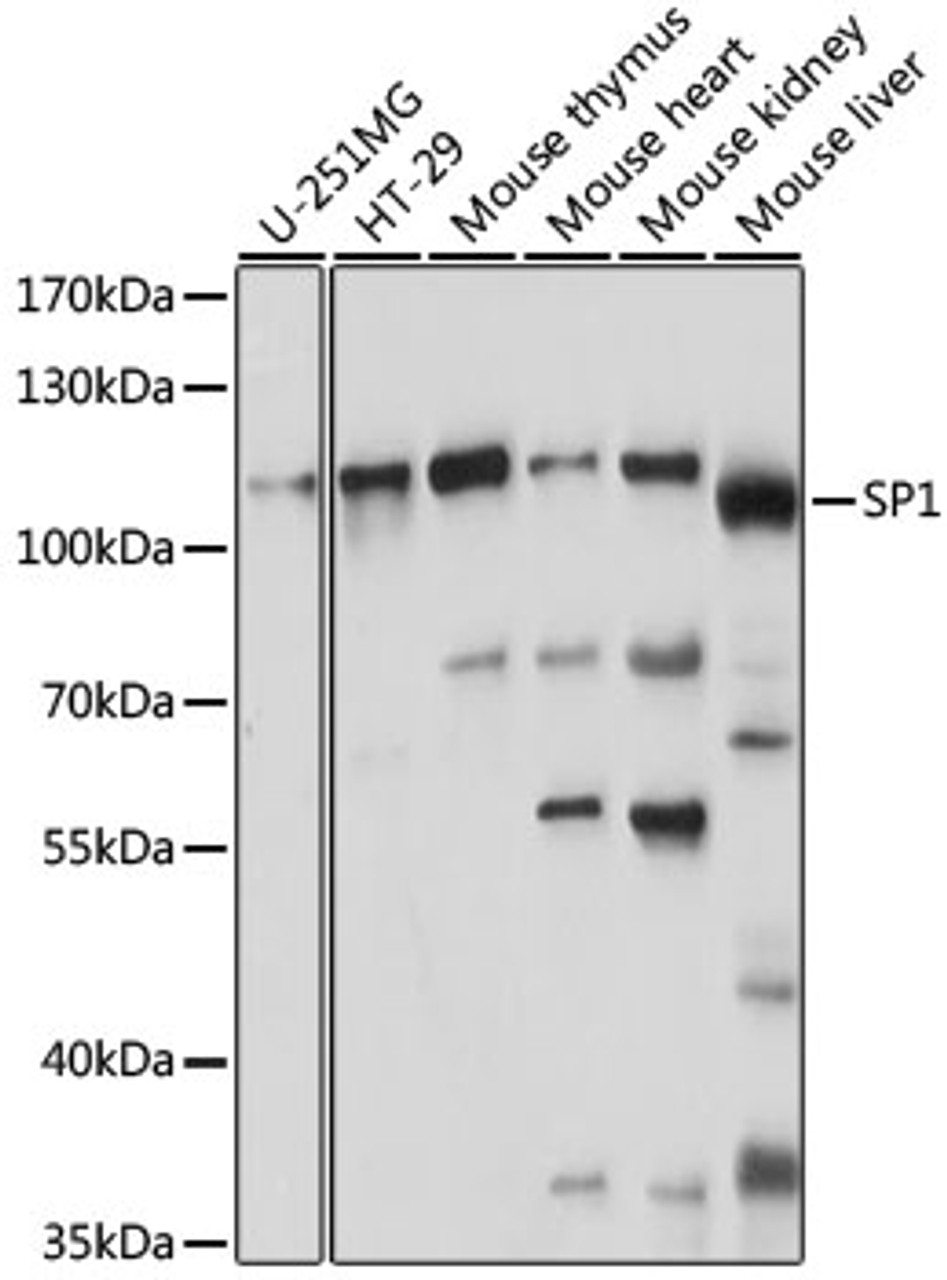Western blot analysis of extracts of various cell lines, using SP1 antibody (15-659) at 1:1000 dilution.<br/>Secondary antibody: HRP Goat Anti-Rabbit IgG (H+L) at 1:10000 dilution.<br/>Lysates/proteins: 25ug per lane.<br/>Blocking buffer: 3% nonfat dry milk in TBST.<br/>Detection: ECL Basic Kit.<br/>Exposure time: 60s.
